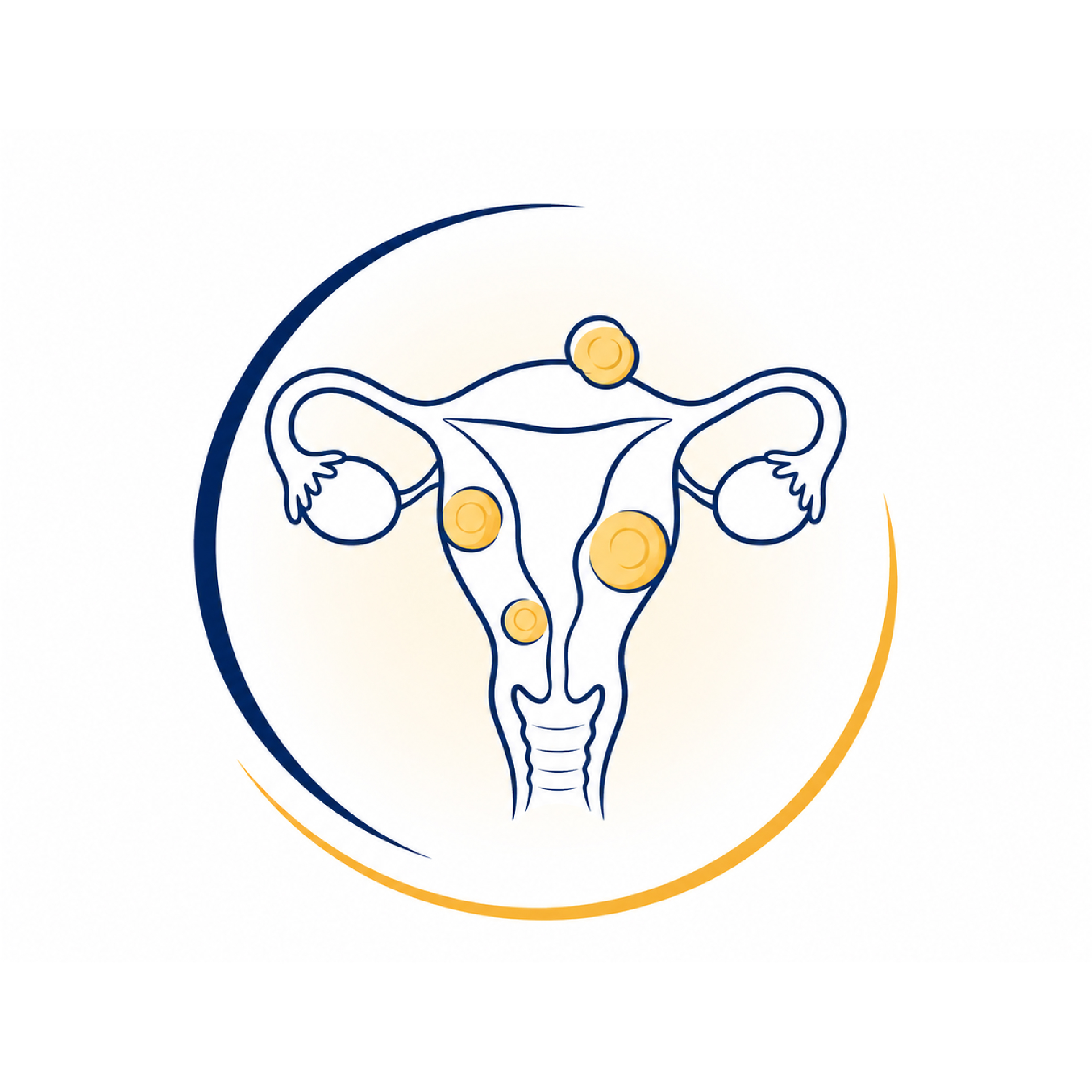 Uterine Fibroids